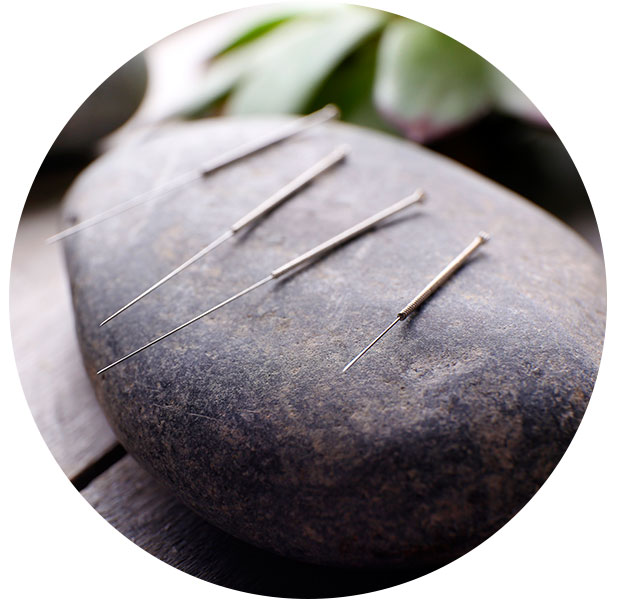 ACUPUNTURA