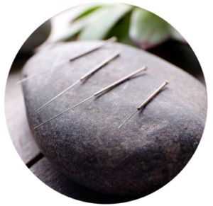acupuntura